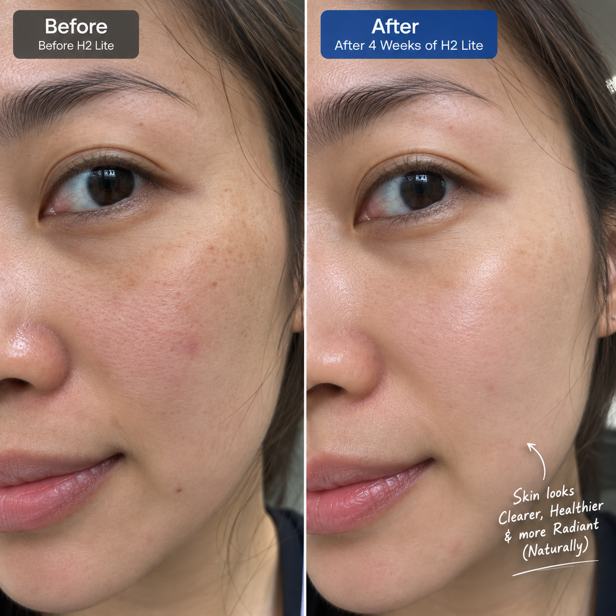 Before and after facial skin comparison on a woman's face, showing clearer and more radiant skin after 4 weeks of H2 Lite. The left side is labeled 'Before' and the right side is labeled 'After', with handwritten text on the right pointing out the skin improvements.